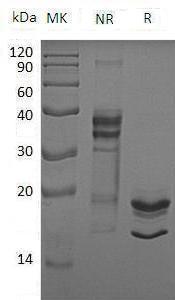 Human S100A8/CAGA/CFAG/MRP8 (His tag) recombinant protein