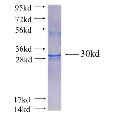 Recombinant human THOC7(Full length) SDS-PAGE