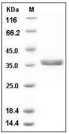 Human Cathepsin S / CTSS Protein (His Tag) SDS-PAGE