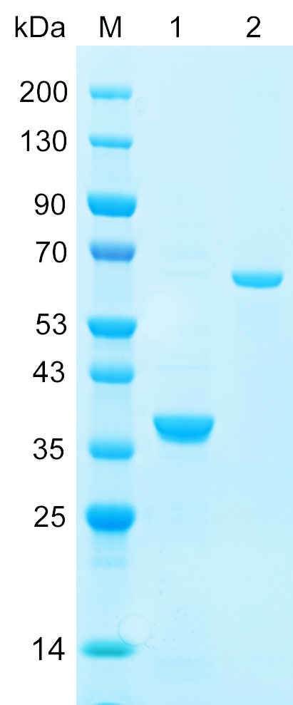 Recombinant NEMO protein (His tag) SDS-PAGE