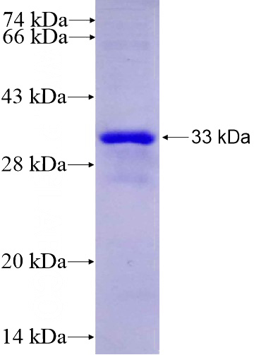 Recombinant Human WDR74 SDS-PAGE