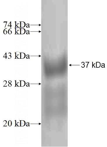Recombinant Human TIMM8A SDS-PAGE