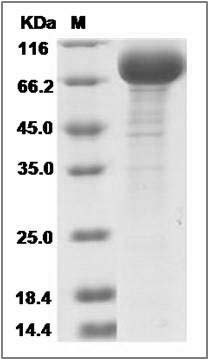 Canine IL18R1 Protein (Fc Tag) SDS-PAGE