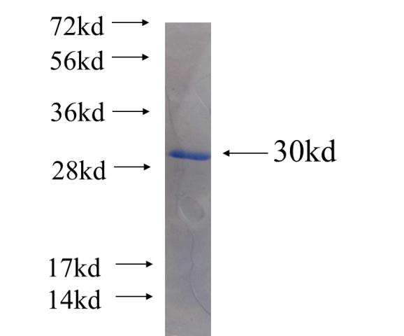 Recombinant human C1orf223 SDS-PAGE