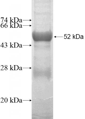 Recombinant Human PPM1L SDS-PAGE