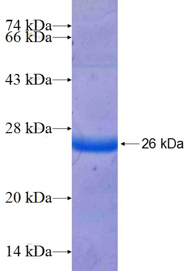 Recombinant Human TPRKB SDS-PAGE