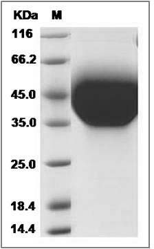 Mouse TIM-3 / HAVCR2 Protein (His Tag) SDS-PAGE