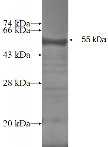 Recombinant Human EIF3J SDS-PAGE