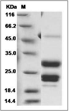 Human AGA / ASRG / Aspartylglucosaminidase Protein (His Tag) SDS-PAGE