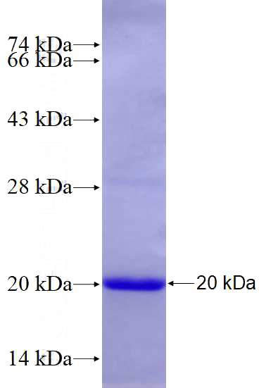 Recombinant Human S1PR1 SDS-PAGE