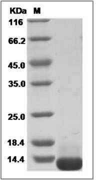 Human COL6A3 / Collagen-VI Protein (His Tag) SDS-PAGE