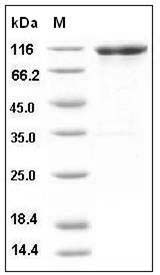 Mouse VCAM1 / CD106 Protein (His & Fc Tag) SDS-PAGE