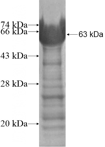 Recombinant Human SLC9A3R2 SDS-PAGE