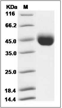 Influenza A H7N9 (A/Anhui/1/2013) Hemagglutinin Protein (HA1 Subunit) (His Tag) SDS-PAGE