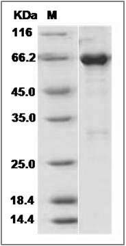 Mouse EphA3 Protein (aa 569-984, His & GST Tag) SDS-PAGE