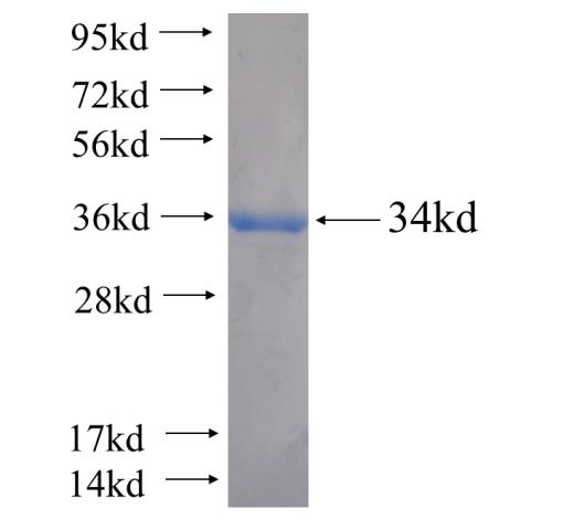 Recombinant human MPPE1 SDS-PAGE