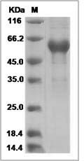 Human RAET1E / ULBP4 Protein (Fc Tag) SDS-PAGE