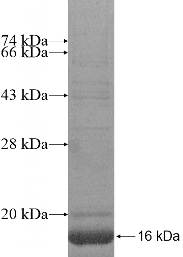 Recombinant Human GPR182 SDS-PAGE