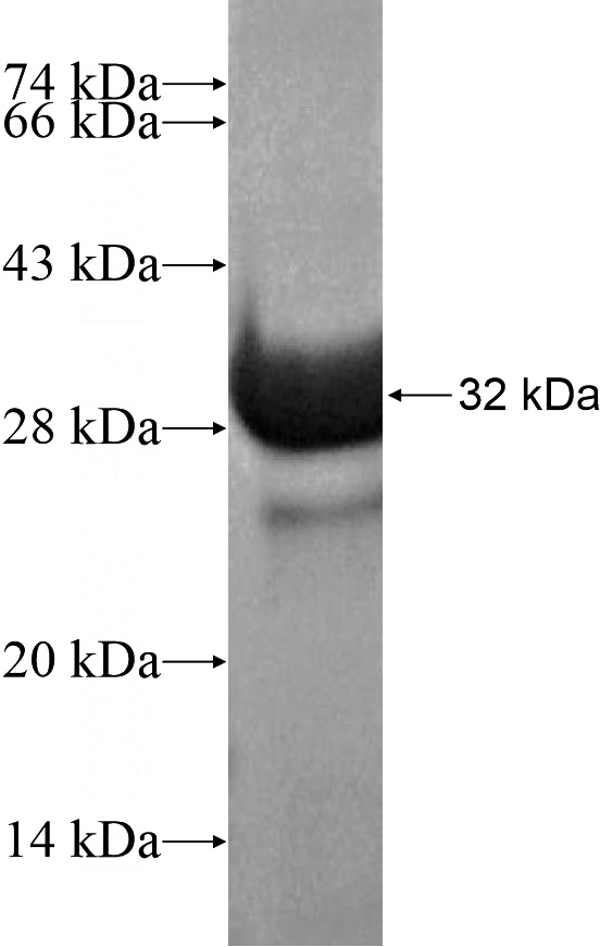 Recombinant Human GBX2 SDS-PAGE