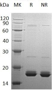 Human CYB5A/CYB5 (His tag) recombinant protein