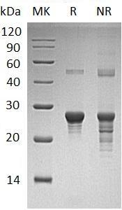 Human PPCDC/COAC/MDS018/UNQ9365/PRO34154 (His tag) recombinant protein