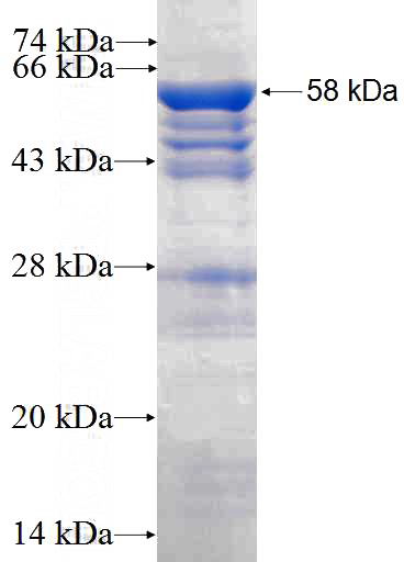 Recombinant Human HNRNPC SDS-PAGE