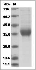 Cynomolgus Erythropoietin / EPO Protein (His Tag) SDS-PAGE