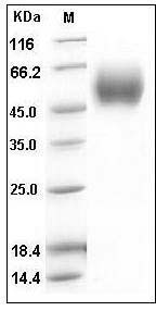 Human IL17RD Protein (His Tag) SDS-PAGE