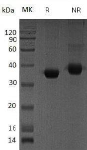 Human SPARC/ON (His tag) recombinant protein
