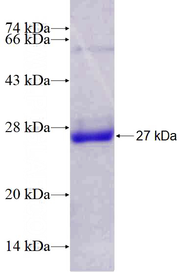 Recombinant Human COMMD1 SDS-PAGE