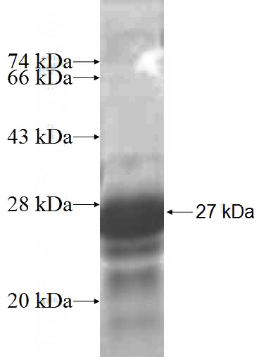 Recombinant Human ST3GAL2 SDS-PAGE