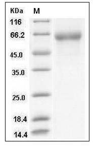 Influenza A H5N1 (A/Duck/Hong Kong/p46/97) Hemagglutinin / HA Protein (His Tag) SDS-PAGE