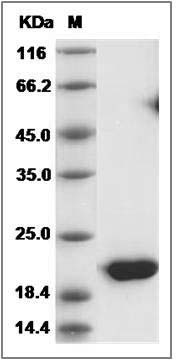 Rat IFNA5 / IFNaG Protein (His Tag) SDS-PAGE