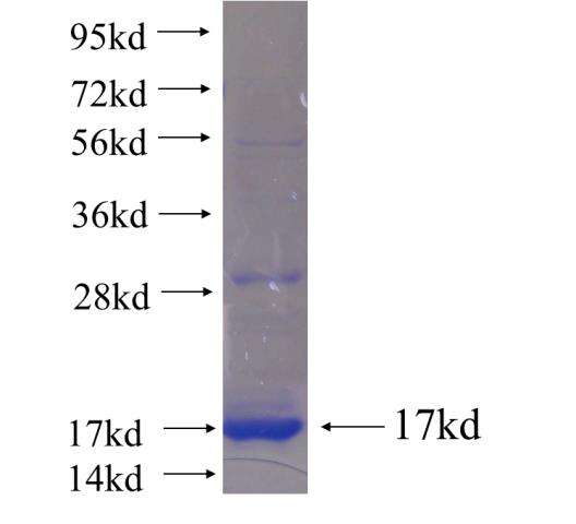 Recombinant human LRRC28 SDS-PAGE