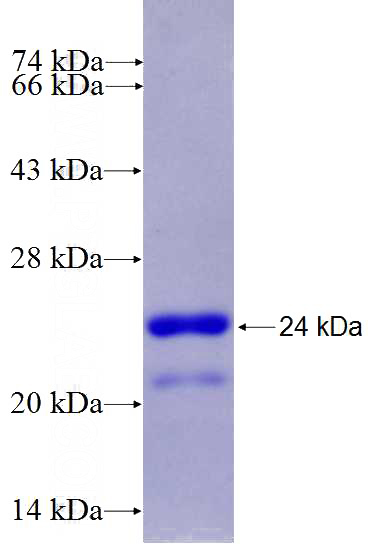 Recombinant Human C2orf56 SDS-PAGE