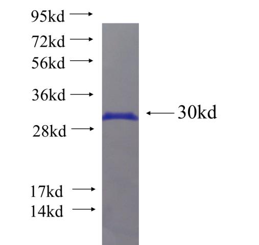 Recombinant human TRDN SDS-PAGE