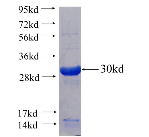 Recombinant human ADARB1 SDS-PAGE