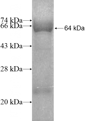 Recombinant Human CASKIN2 SDS-PAGE