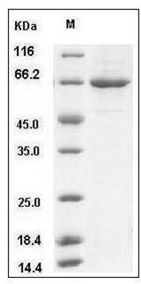 Mouse PLK1 / PLK-1 Protein (His Tag) SDS-PAGE