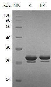 Mouse Fgf17 (His tag) recombinant protein