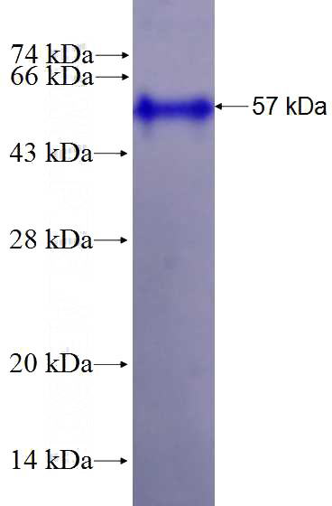 Recombinant Human HNRPDL SDS-PAGE