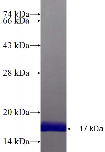 Recombinant Human CHCHD5 SDS-PAGE