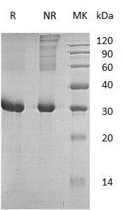 Human RGMA/RGM (His tag) recombinant protein