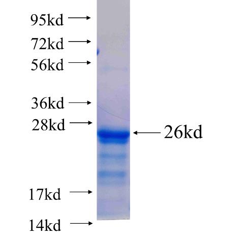 Recombinant human KDM2A SDS-PAGE
