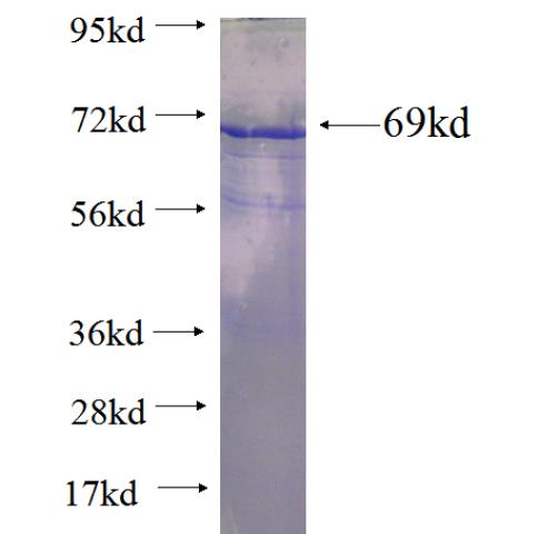 Recombinant human TYW1B SDS-PAGE