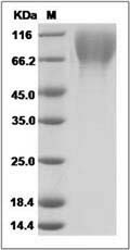 Human LAMP2 / CD107b Protein (His Tag)