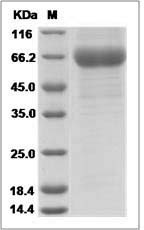 Influenza A H3N1 (A/swine/Korea/PZ72-1/2006)] Hemagglutinin / HA1 Protein (His Tag)