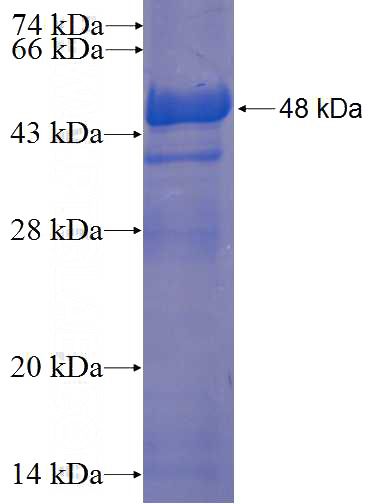 Recombinant Human SPC24 SDS-PAGE