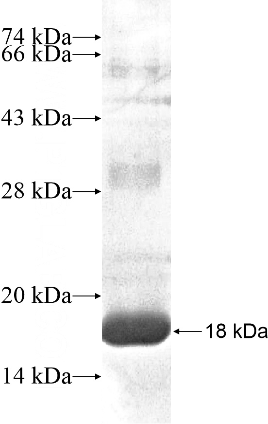 Recombinant Human CNFN SDS-PAGE