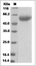 Influenza A H5N1 (A/chicken/Jilin/9/2004) Hemagglutinin Protein (HA1 Subunit) (His Tag)
